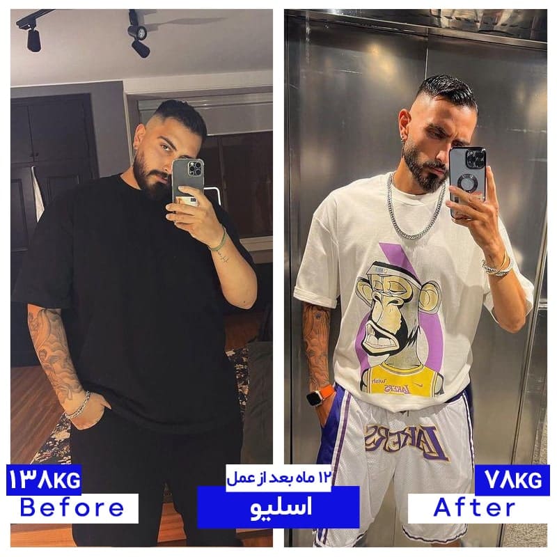 ۷۸ کیلو کاهش وزن