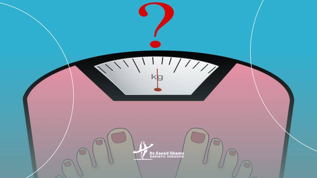 استپ وزن بعد از عمل اسلیو