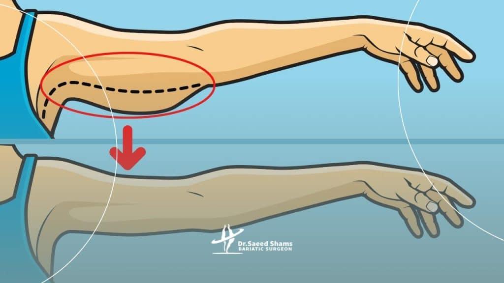 لاغر شدن صورت و افتادگی پوست