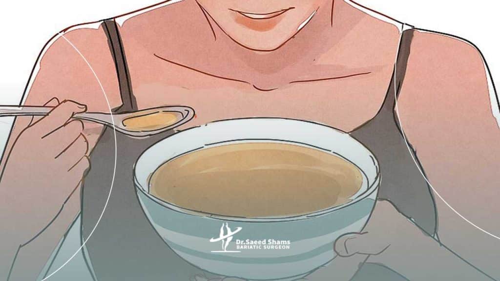 رژیم غذایی هفته دوم بعد از اسلیو معده