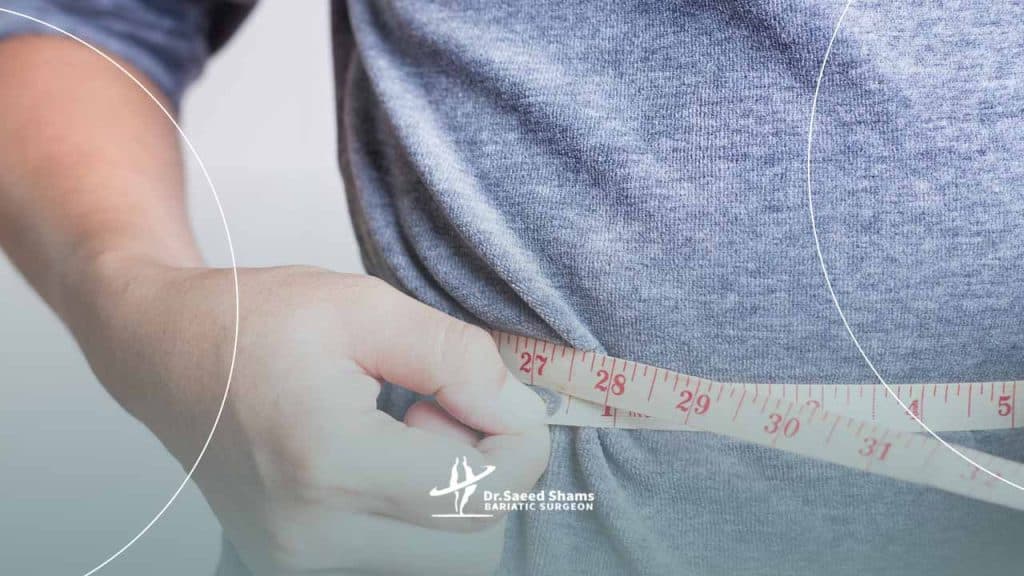 دلایل استپ وزن بعد از عمل اسلیو