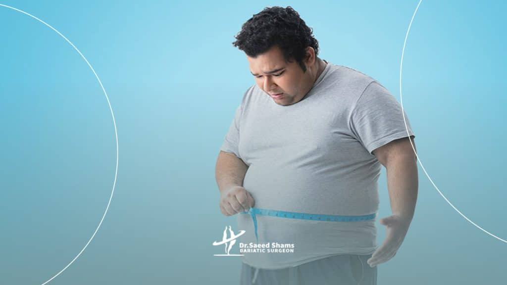 دلیل چاقی و اضافه وزن چیست؟