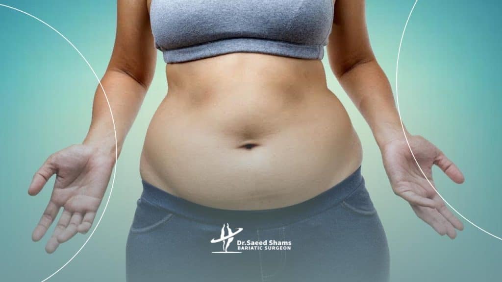 اقدامات قبل از جراحی