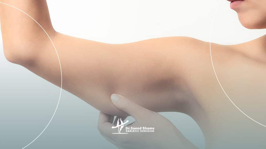 بهترین روش جلوگیری از افتادگی پوست بعد از عمل اسلیو چیست؟