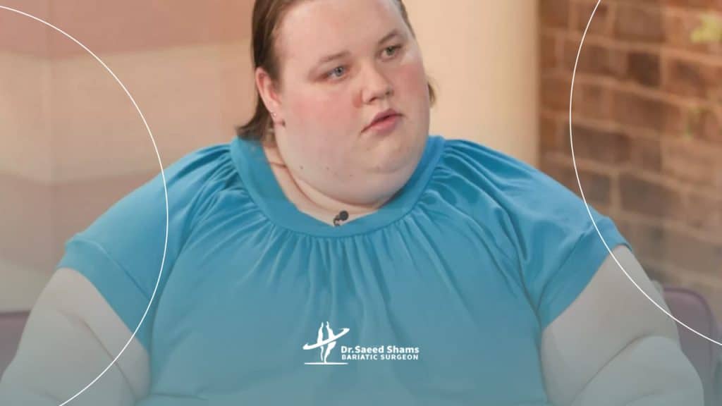 حداقل سن برای انجام جراحی لاغری