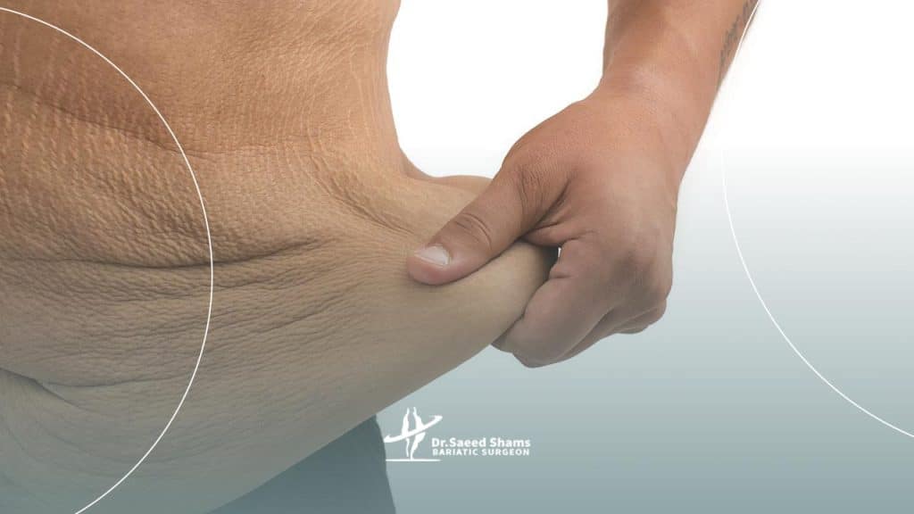 افتادگی پوست