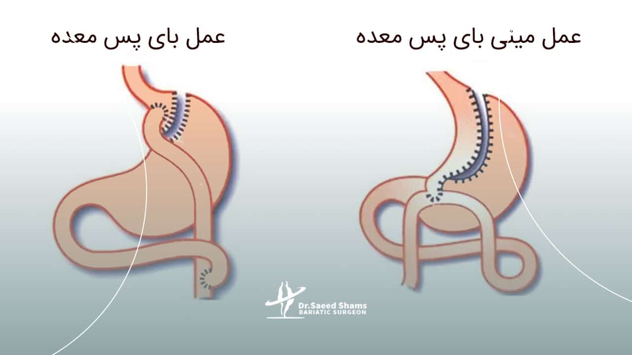 روش انجام جراحی
