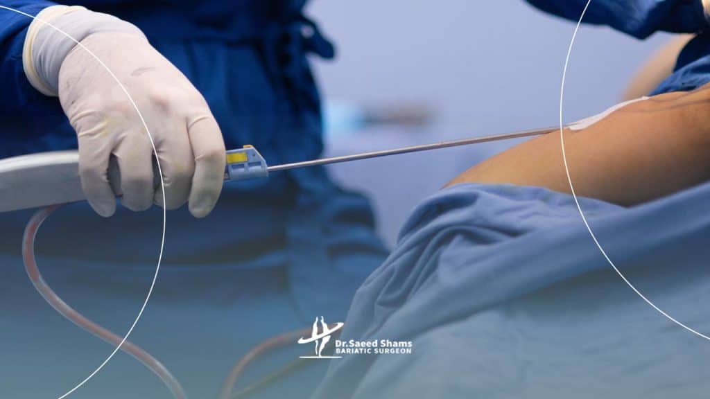 عمل پیکرتراشی چگونه انجام میشود؟