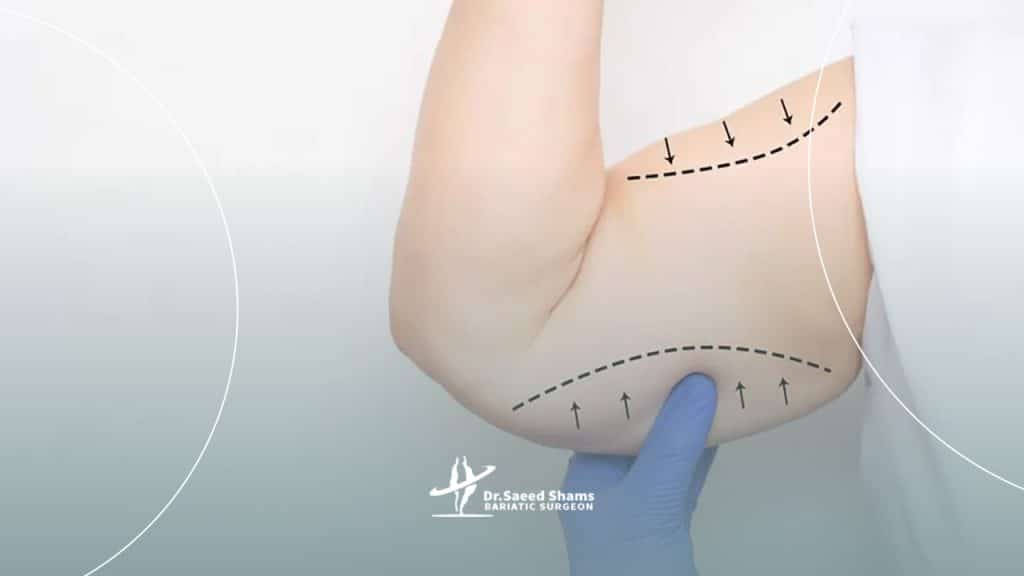 چه کسانی می توانند پیکر تراشی انجام دهند؟