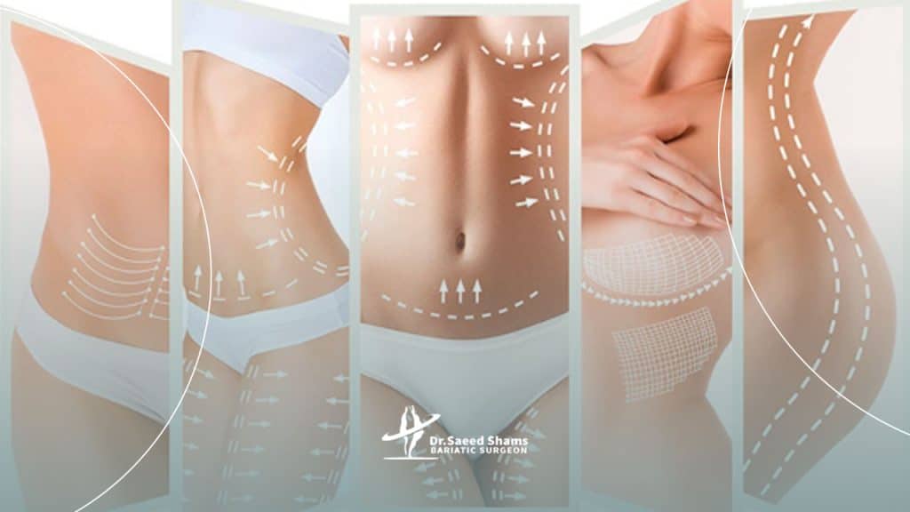 عمل پیکرتراشی با جراحی