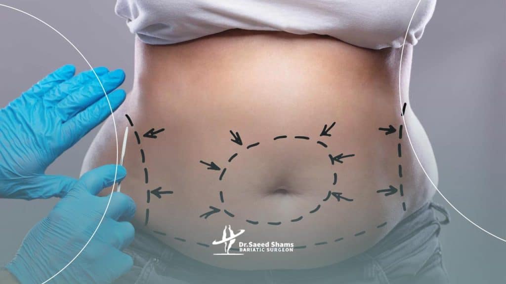 هزینه پیکر تراشی چقدر است؟