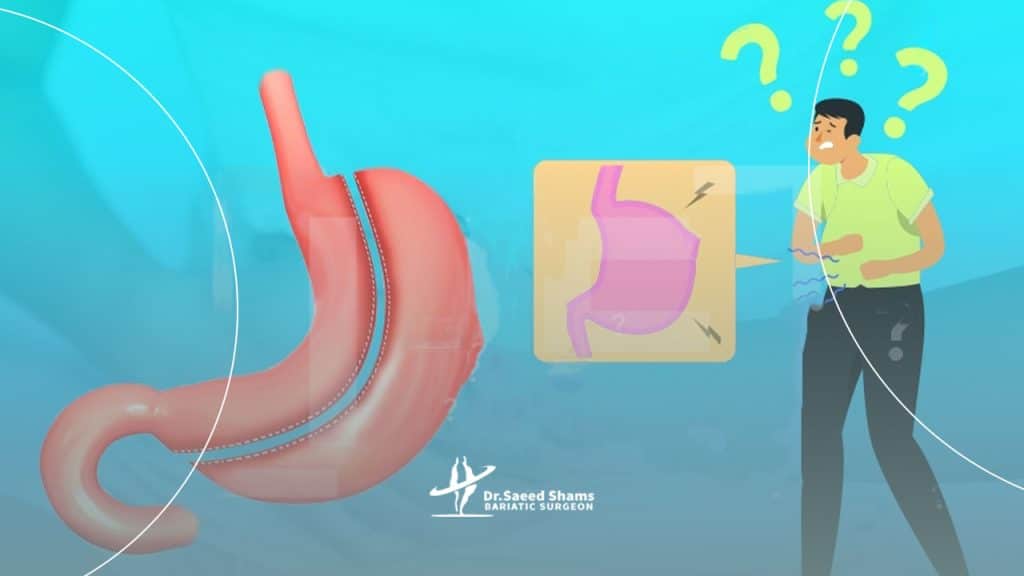 درد بعد از عمل اسلیو
