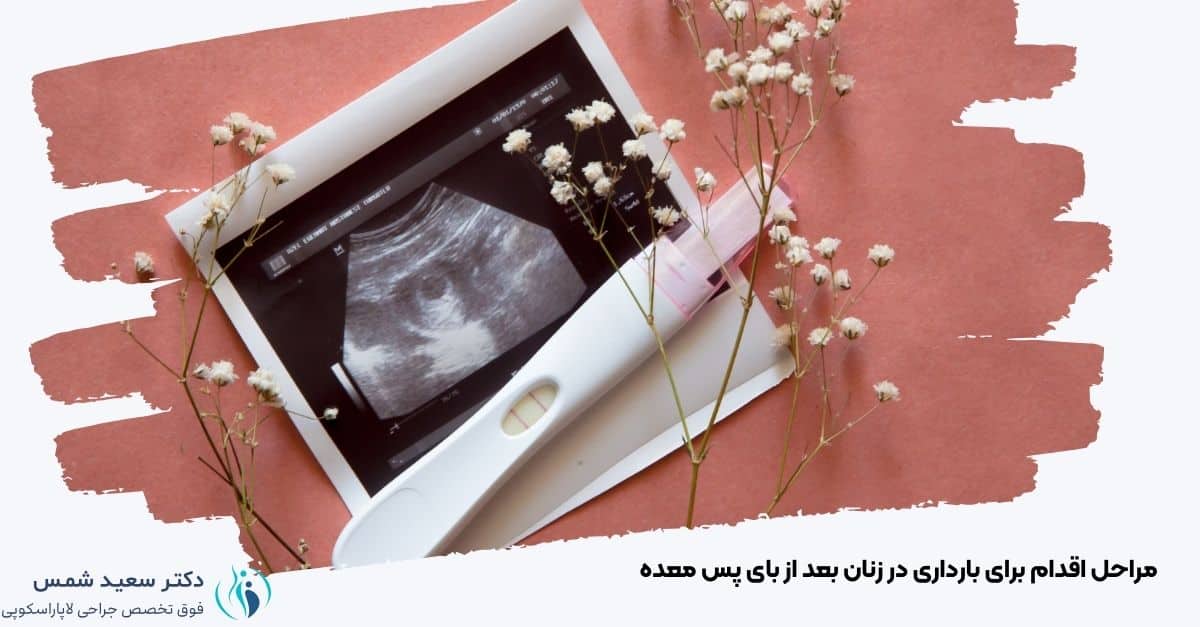 مراحل اقدام برای بارداری در زنان بعد از بای پس معده