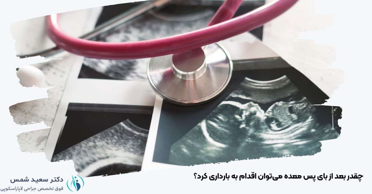 چقدر بعد از بای پس معده میتوان اقدام به بارداری کرد؟