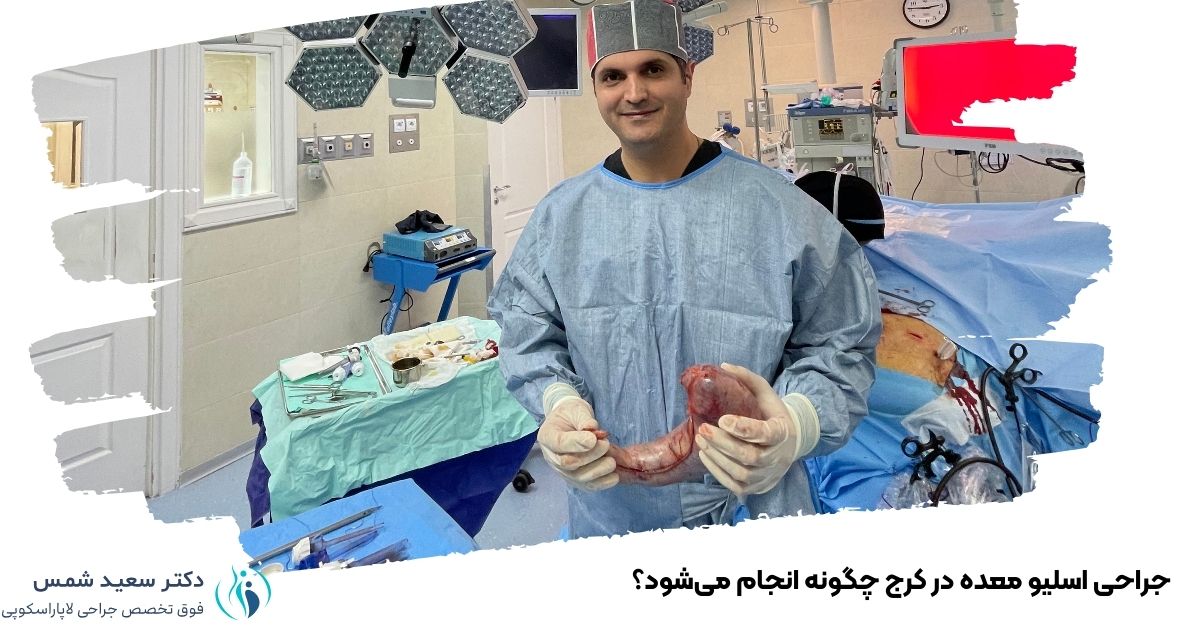 جراحی اسلیو معده در کرج چگونه انجام میشود؟