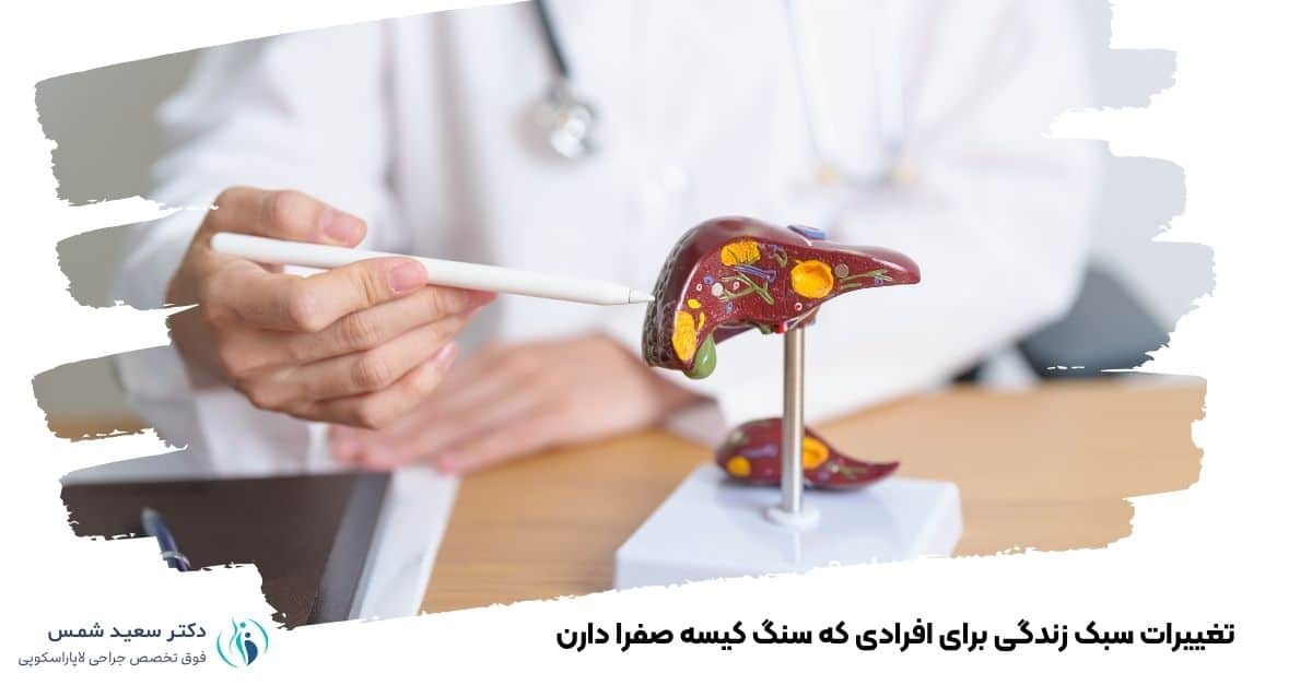 تغییرات سبک زندگی برای افرادی که سنگ کیسه صفرا دارن