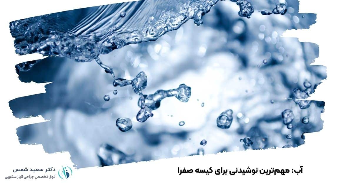آب: مهمترین نوشیدنی برای کیسه صفرا