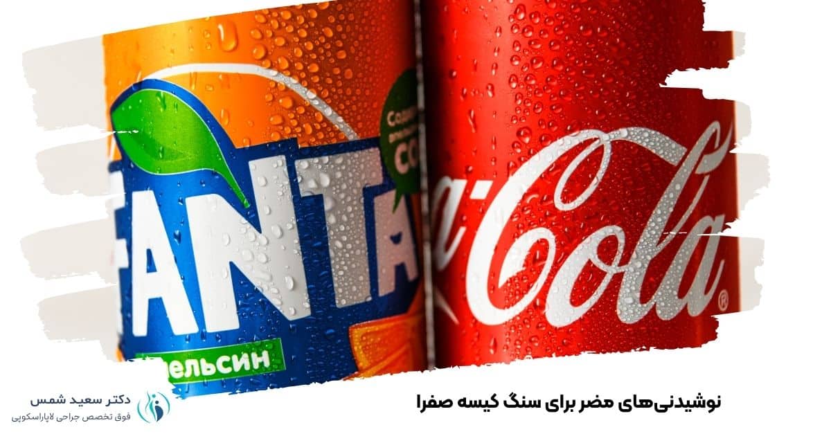 نوشیدنیهای مضر برای سنگ کیسه صفرا