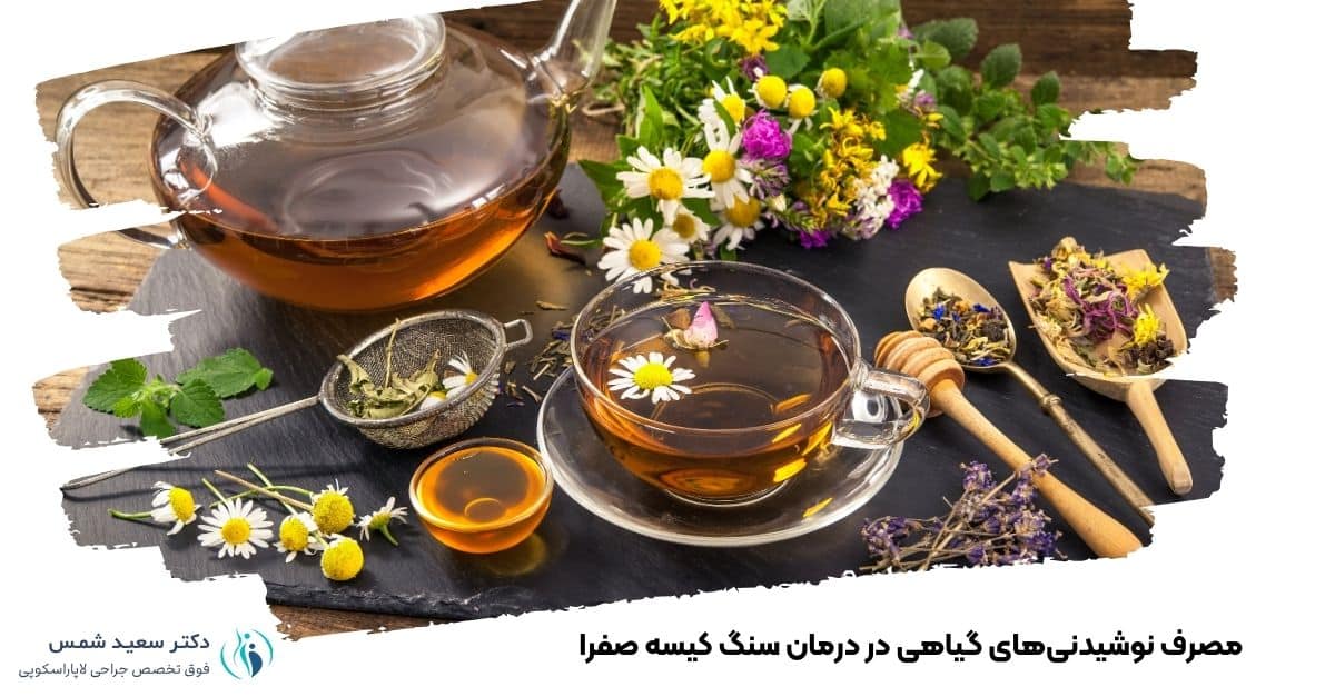 مصرف نوشیدنیهای گیاهی در درمان سنگ کیسه صفرا