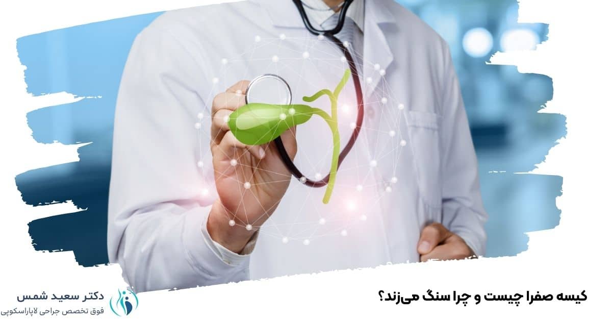 کیسه صفرا چیست و چرا سنگ میزند؟