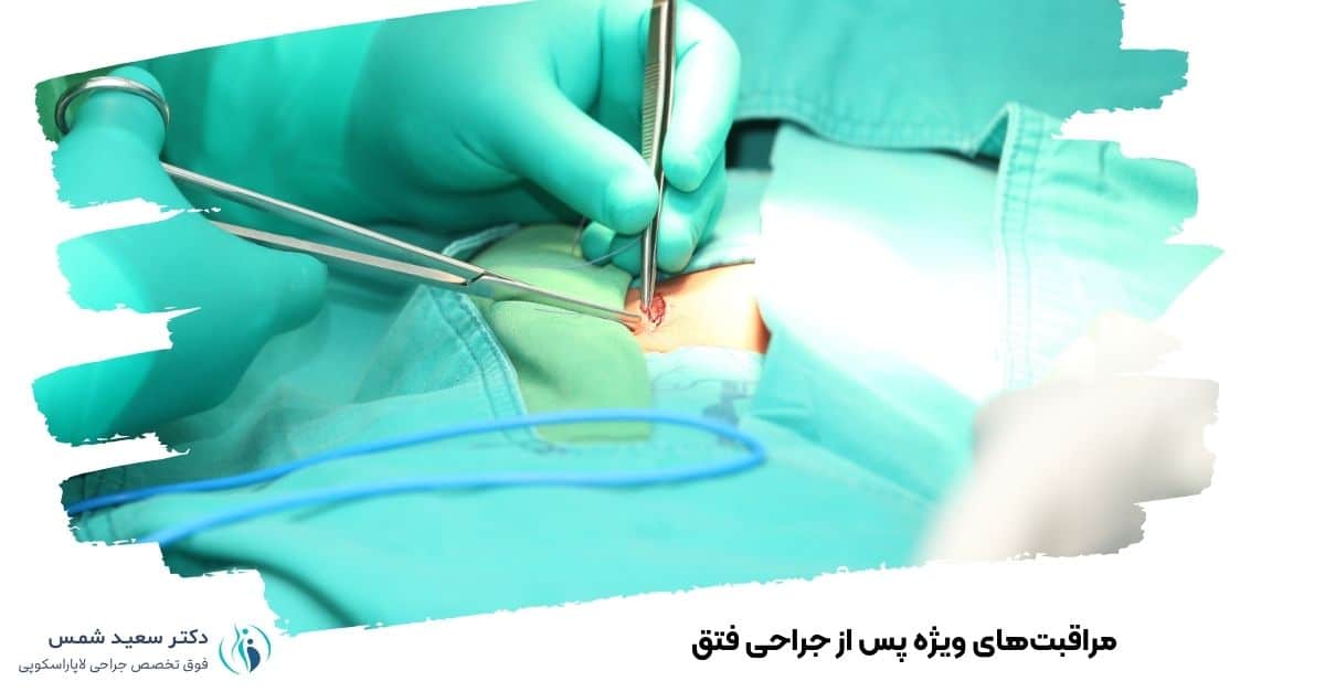 مراقبتهای ویژه پس از جراحی فتق