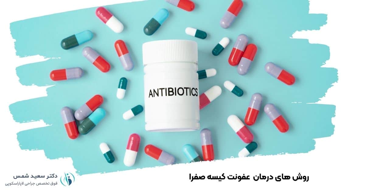 روش های درمان عفونت سنگ کیسه صفرا