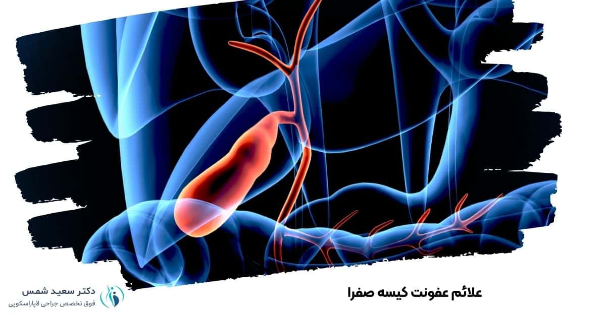 علائم عفونت کیسه صفرا