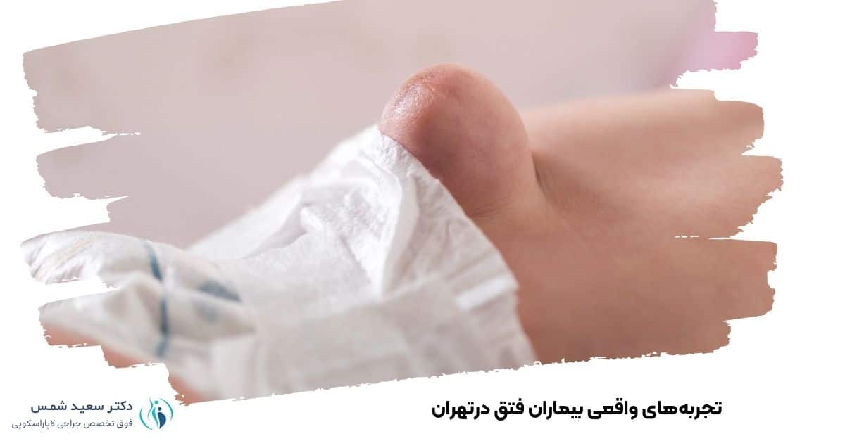 تجربههای واقعی بیماران فتق درتهران