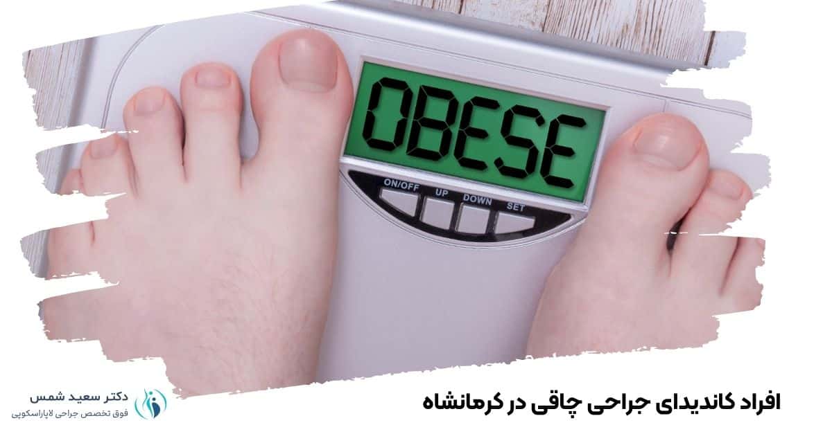 جراح اسلیو در کرمانشاه