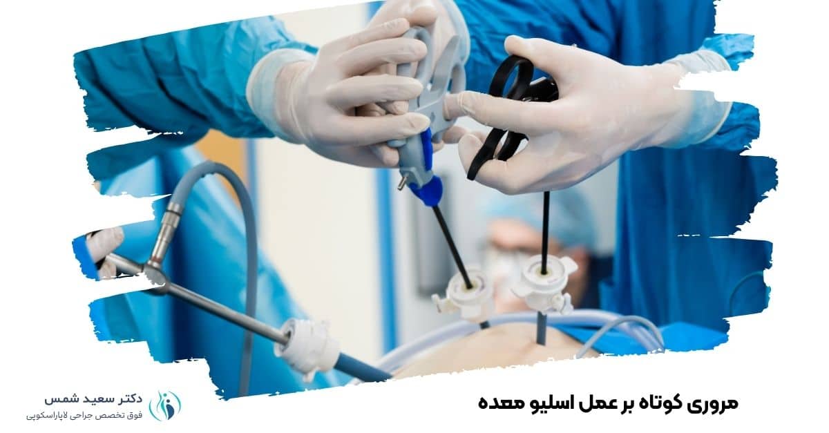 مروری کوتاه بر عمل اسلیو معده