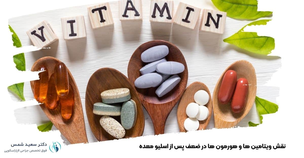 نقش ویتامین ها و هورمون ها در ضعف پس از اسلیو معده